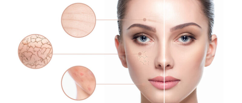 PN Cell Aqua Vital za regeneraciju kože