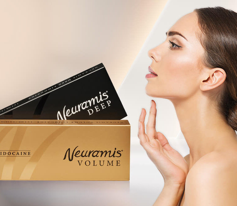 Neuramis fileri