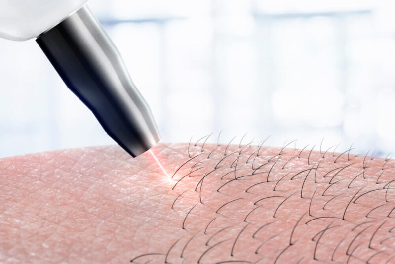 Diodni laser