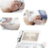 8D HIFU mrsavljenje Vector Medical Group