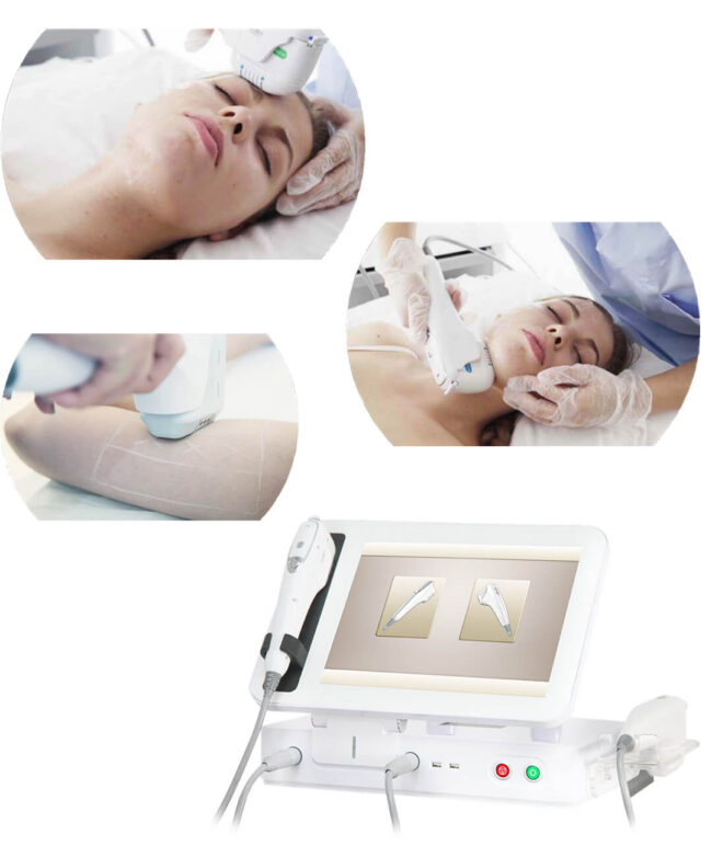 8D HIFU mrsavljenje Vector Medical Group